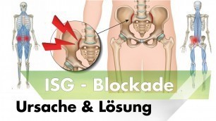 'ISG Blockade | Symptome, Ursachen & Lösung durch Training'