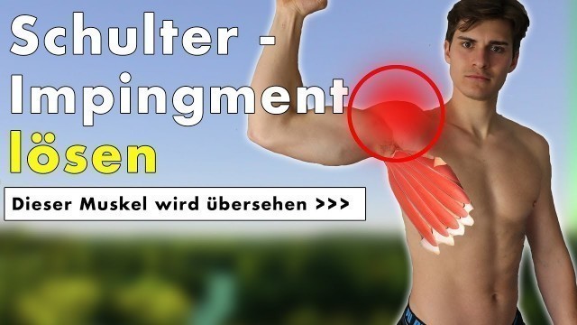 'Schulterimpingement geht nicht weg? | Dieser Muskel ist die Ursache! (+ Übung)'