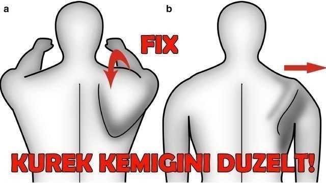 'FAZLA ÇIKAN KÜREK KEMİKLERİNE SON! ( Winging Scapula ) KESİN ÇÖZÜM!'